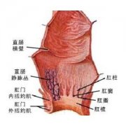 直肠癌早期会有哪些症状?