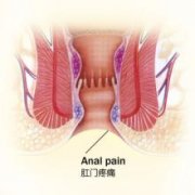 肛门疼痛是由哪些疾病引起的?