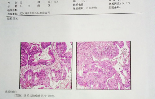 病理诊断报告前