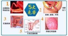 外痔的五大危害?