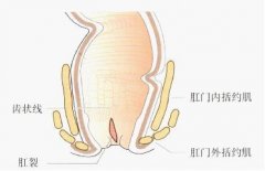 肛裂pilesask是怎么回事?肛裂的危害大吗?