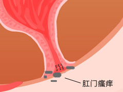 肛门瘙痒原因