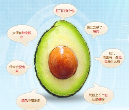 肛门异物症状