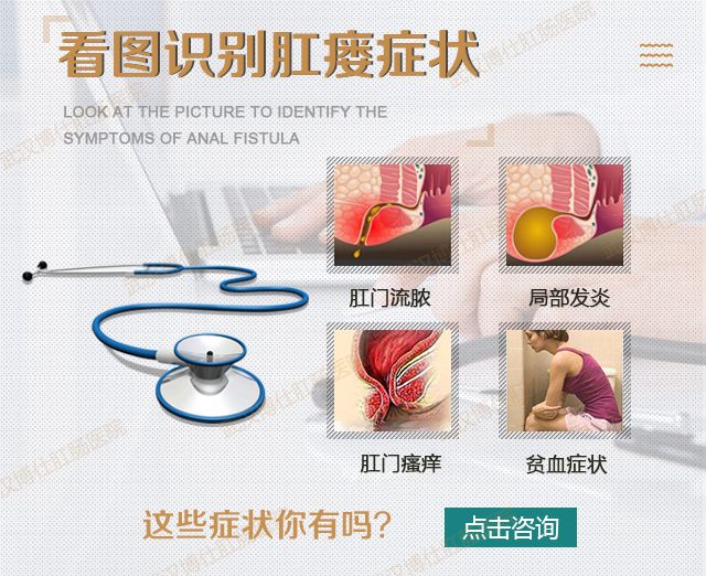 肛瘘症状