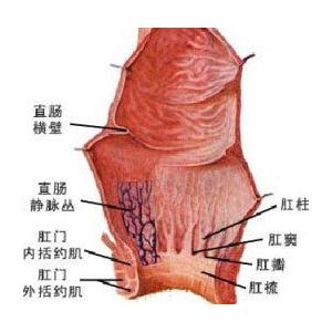 直肠癌症状