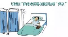 男子患直肠癌，秦教授用这种办法让他免受“粪